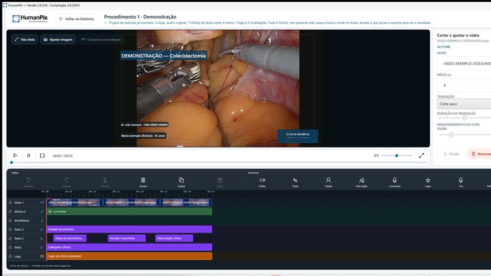 Editor de v&iacute;deo do HumanPix Software com pr&eacute;via do procedimento, corte e ajuste e linha do tempo com trilhas
