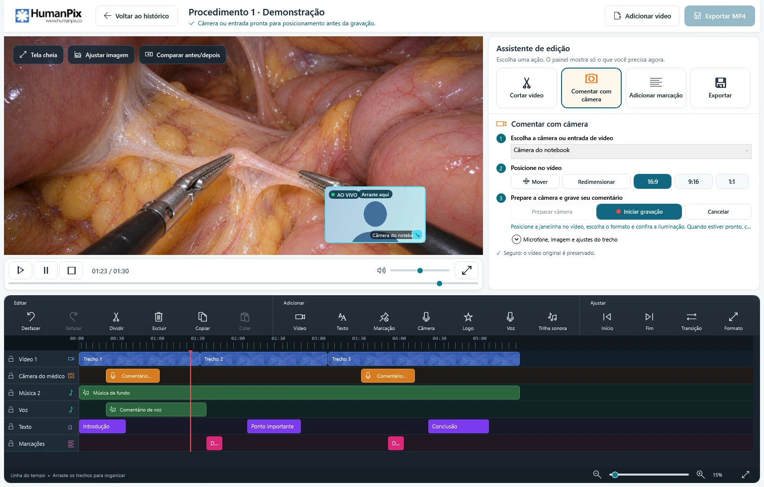 Editor de v&iacute;deo do HumanPix com a pr&eacute;via do procedimento, os pain&eacute;is de edi&ccedil;&atilde;o e a linha do tempo com v&iacute;deo, m&uacute;sica, voz e textos